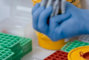 How to Choose the Right Method for Custom Peptide Synthesis?